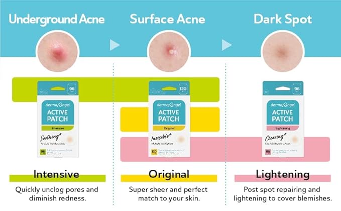 DERMA ANGEL Dark Spot Patches Blemish Patches with Hydrocolloid, TXA & CICA for Active Acne & Post-Inflammatory Dark Spots - Day and Night Use - UPGRADED (Post Acne - 96 Count - 1 Size)