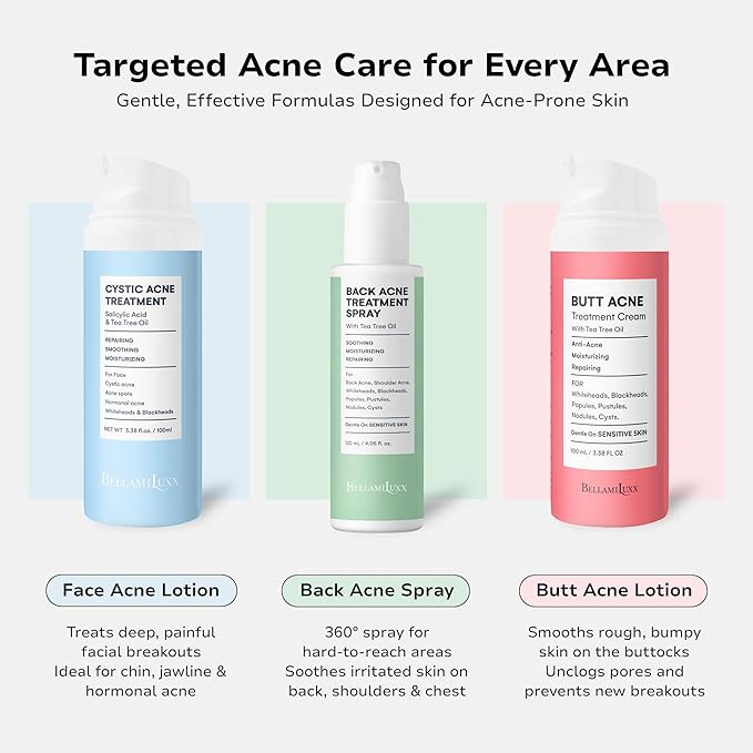 Cystic Acne Treatment for Face: Hormonal Acne Treatment Cream for Teens & Adults - Salicylic Acid & Tea Tree Oil Pimple Spot Remover - Anti-Acne Moisturizer Reduces Redness, Blemishes