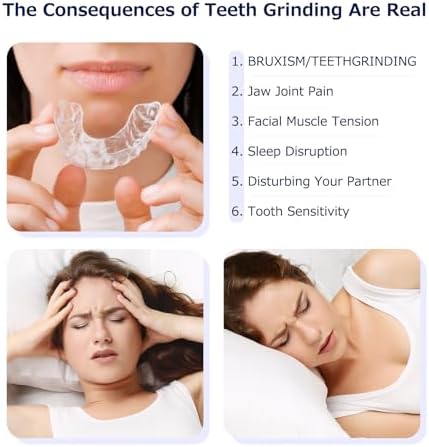Custom Fit Night Guard for Bruxism & Teeth Clenching - Comfortable & BPA-Free - Protects Teeth & Reduces Jaw Tension - Includes Case & Easy-to-Use Mold Kit