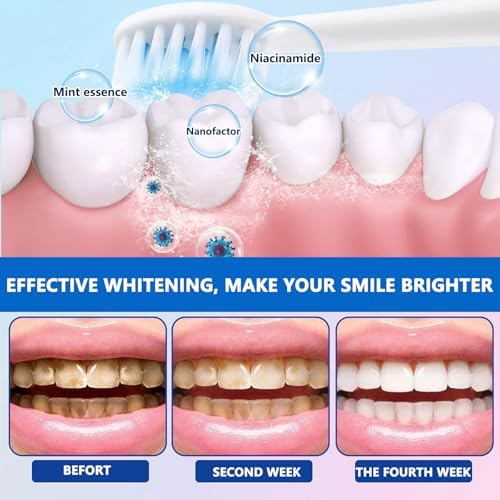 Niacinamide Whitening Toothpaste, Effectively Whitens Teeth, Protects Tooth Enamel, Freshens Breath 24 Hours, Fluoride-Free Formula is Suitable for Sensitive Teeth