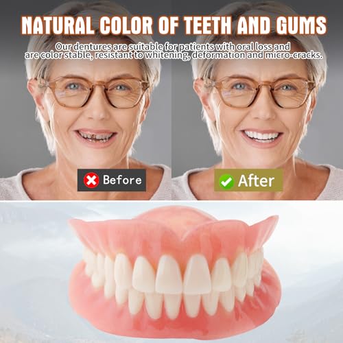 Diy denture kit convenient and easy Xuyuqual diy dentures kit at home complete make your own dentures kits for top and bottom of temporary repair missing teeth Z1