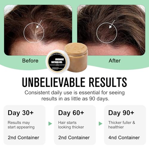 Divine Vitals Batana Oil for Hair Growth, Divine Vitals Organic Batana Hair Growth Oil, Treats Dry Hair, Suitable for all hair types, for Men and Women(2Pcs-4.23Oz)
