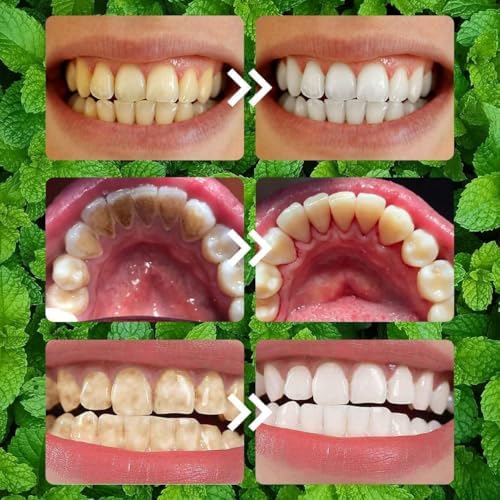 2 Pcs Teeth Restoration Mineral Powder Mineral whitening for Freshen Breath Whitening Natural Teethrestoration Powder Effective in Strengthening and Gums