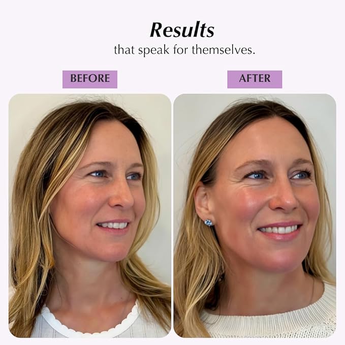 SHIMMER CHEF Grapefruit Glacé Morning Face & Body Balm Organic Skincare with Grapefruit Peel Concentrate Aloe Shea and Mango Butters Hydrates Protects Radiant Shimmery Skin Mood Uplift 1.5 oz