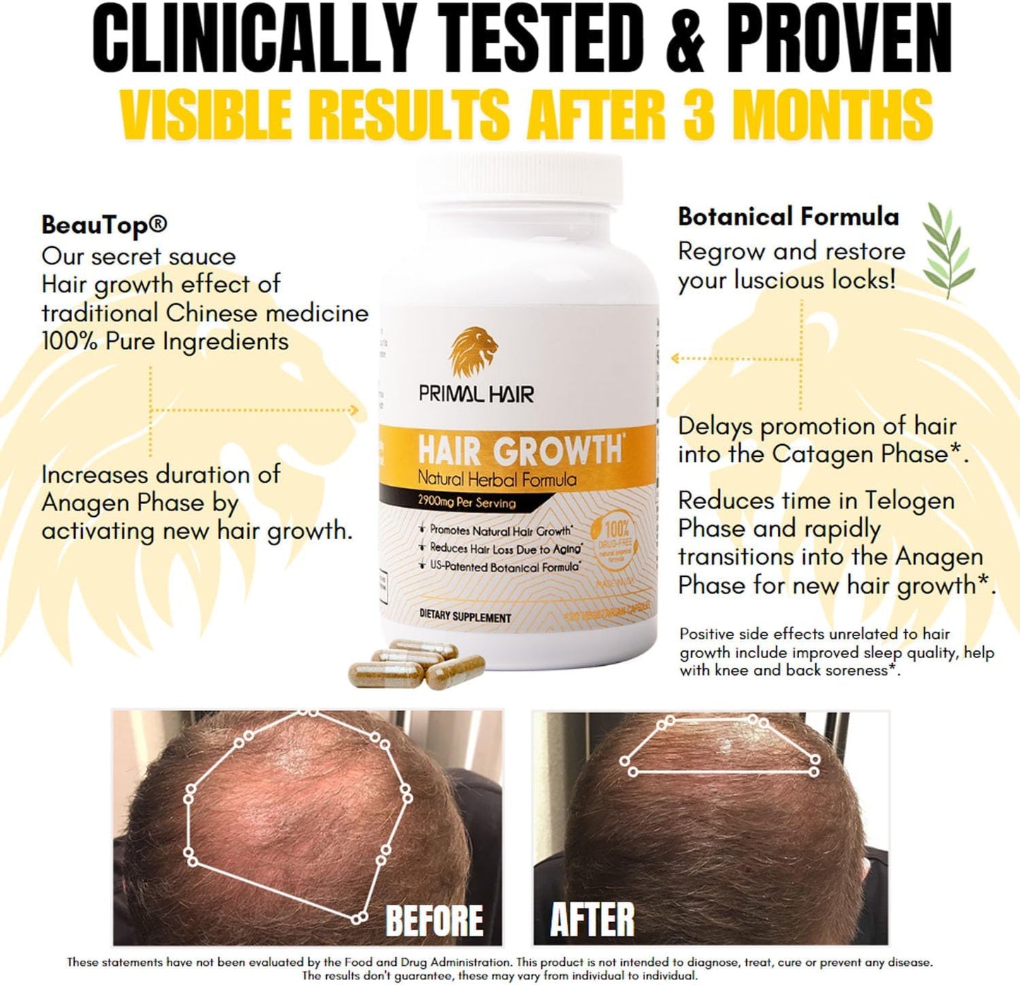 3 PK- 100% Natural Growth Treatment, Reduces Hair Loss, US Patented Formula Proven Effective for Men & Women, 100% Vegan, Non-GMO, 90-Day Supply, 3 Pack