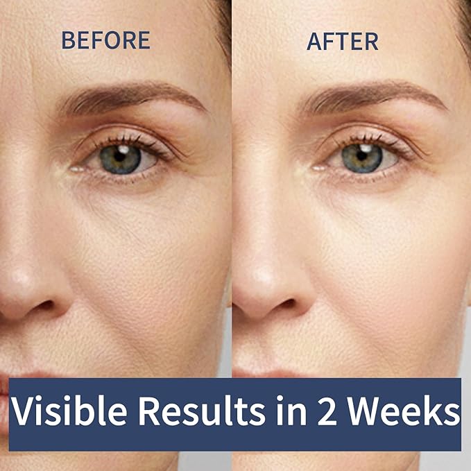 2PCS Vitaliq Calcium Multi Balm, Calcium Volume Multi Balm, Wrinkle Core Stick for Face, Collagen Moisturing Stick, Anti-aging, Hydrating, Moisturizing Cream