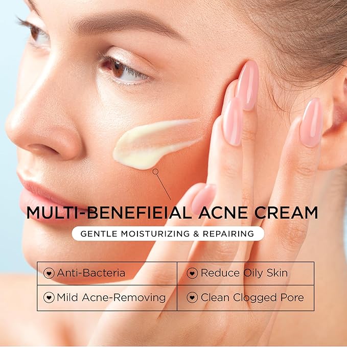Cystic Acne Treatment for Face: Hormonal Acne Treatment Cream for Teens & Adults - Salicylic Acid & Tea Tree Oil Pimple Spot Remover - Anti-Acne Moisturizer Reduces Redness, Blemishes