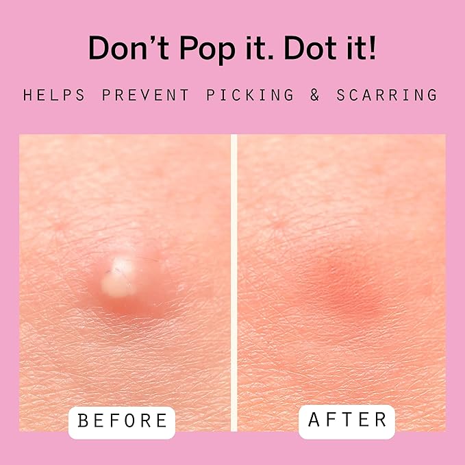 Dot Pimple Zit Patches for Face – Dermatologist Recommended & Ranked 1 for Most Effective Blemish Support – All Natural Hydrocolloid Acne Stickers with Vitamin C & Salicylic Acid (8 & 12 mm, 72 ct)